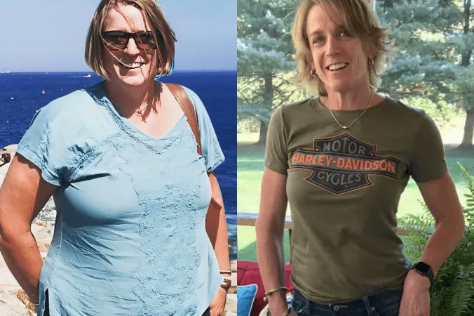 Amy S. before and after