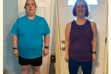 Clare D. before and after